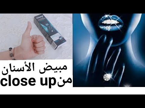 تبييض الأسنان من   ريفيو عن مبيض الأسنان من   ورأيى وتجربتى هتتفاجئوا