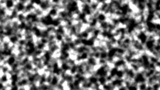 Spinodal decomposition of a gelling nanoemulsion