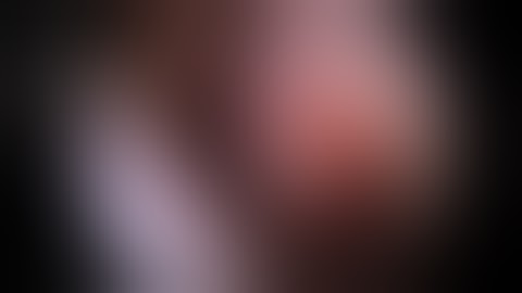 ENTLaser Turbinate Reduction