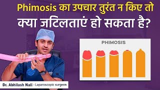 Phimosis Complications In Hindi || Live Demo on Tight Foreskin Treatment || Dr Abhilash Nali