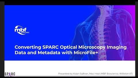 Webinar: Using MicroFile+ to Convert Large Image Data