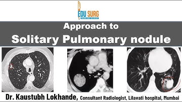 Solitary pulmonary nodule - When to suspect lung cancer - characteristics and follow up - Approach