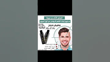 كفاية أعذار ورجع شعرك الي طار 