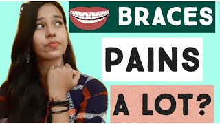 Do Braces Pains A Lotbraces Pain My Braces Journeybraces Q N A Life With Bracesbraces