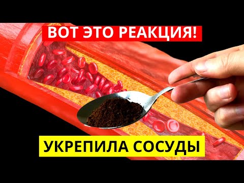 Вот Настоящая Правда! Реакция Сосудов На Кофе Вас Удивит