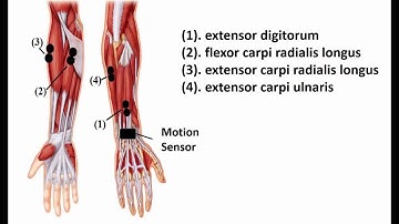 Real time American Sign Language Recognition using Wrist worn Motion and Surface EMG sensors