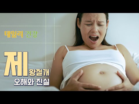 [데일리 건강] 제왕절개에 대한 오해와 진실!