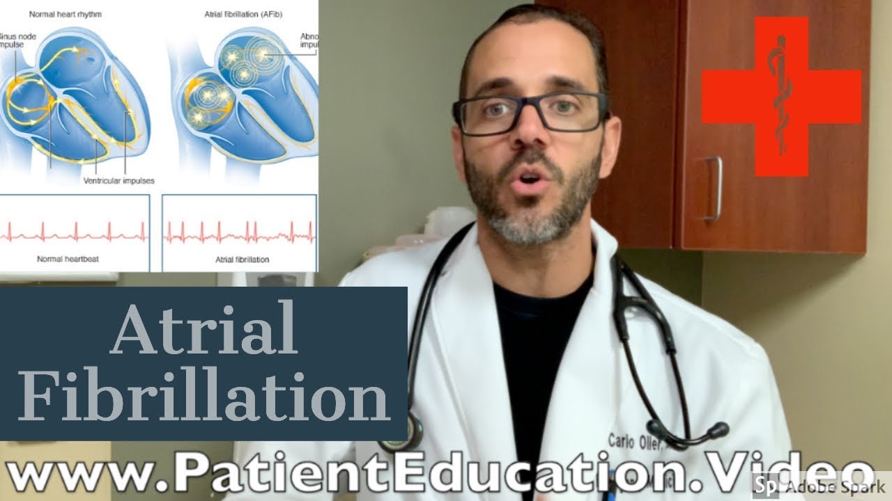 Atrial Fibrillation Tachycardia a patient education video by Dr