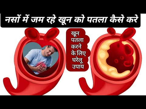 HEART ATTACK द ल क द र इल ज घर ल उप य ख न पतल क स कर Naturopathy Treatments