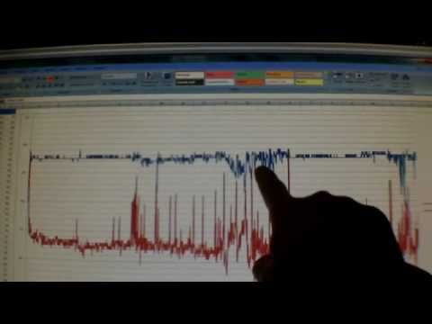 oximiter-for-blood-oxygen-testing:-sleep-apnea-check---part-2