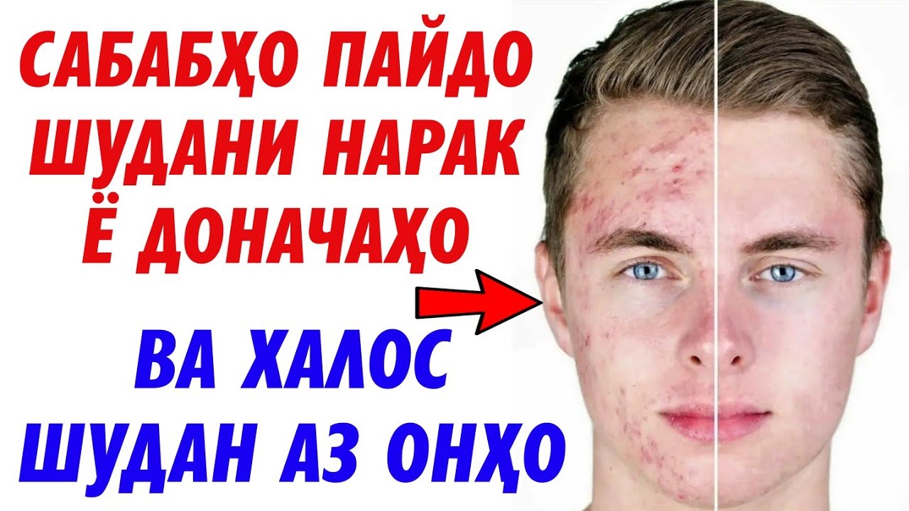 Маз барои нарак