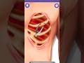 human ribs broken surgery 🍀#medical #viralvideo #babu #kids #games #gaming #neet #medical #cartoon