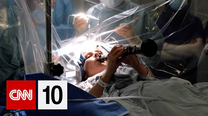 A musician plays the clarinet during her own brain surgery | November 6, 2025