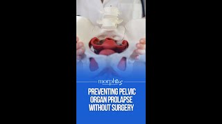 Preventing Pelvic Organ Prolapse Without Surgery in Menopause