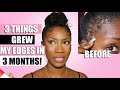 YOUR FAV WIGS TOOK MY EDGES! HOW I GREW MY EDGES BACK WITHIN MONTHS ONLY 3 SIMPLE THINGS | VanessaK7