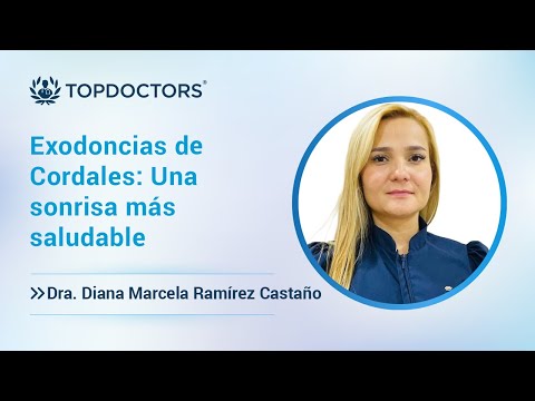 Exodoncias de Cordales: Una sonrisa más saludable