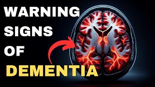 Dementia: Early Signs You Shouldn't Ignore