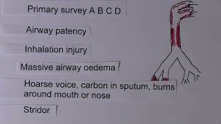 Burns 9, Systemic effects   Airway and Breathing