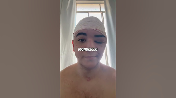 Sofri um grave acidente de monociclo 😔