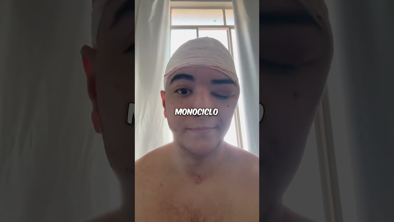 Sofri um grave acidente de monociclo 😔