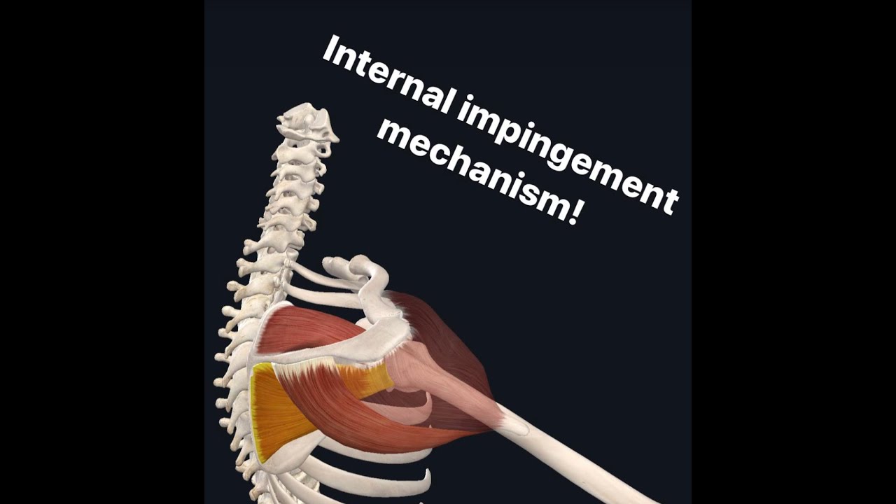 Internal Impingement