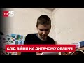 Війна понівечила її обличчя. Історія 14-річної Марини Колій, якій вдалося вибратись з Чугуєва - ТСН