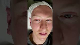 Skin Laser Treatment In Korea