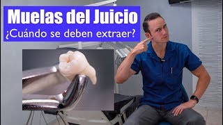MUELAS DEL JUICIO | ¿EXTRAERLAS O NO? CÓMO SABERLO “Cordales o terceros molares”