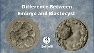 What is the difference between an Embryo and Blastocyst | IVF Specialist