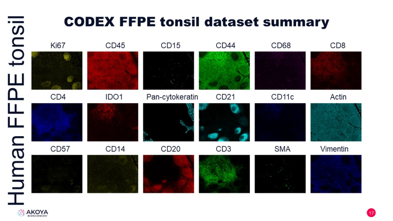 Akoya Biosciences Webinar Series: Comprehensive Meta-analysis of Biomarker Technologies...