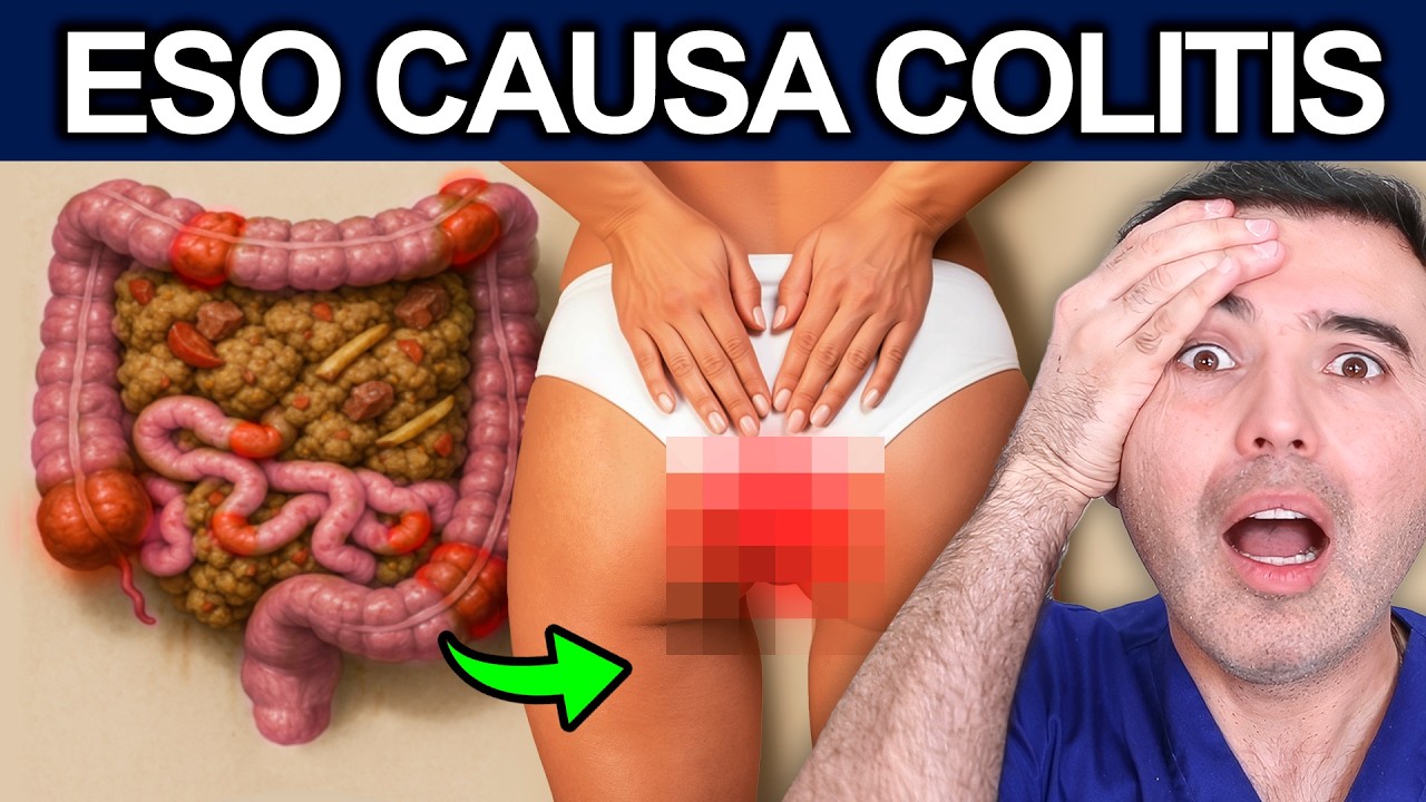 ¡COLITIS REVERTIDA! La Guía COMPLETA para SANAR Colitis Ulcerosa (Garantizado)