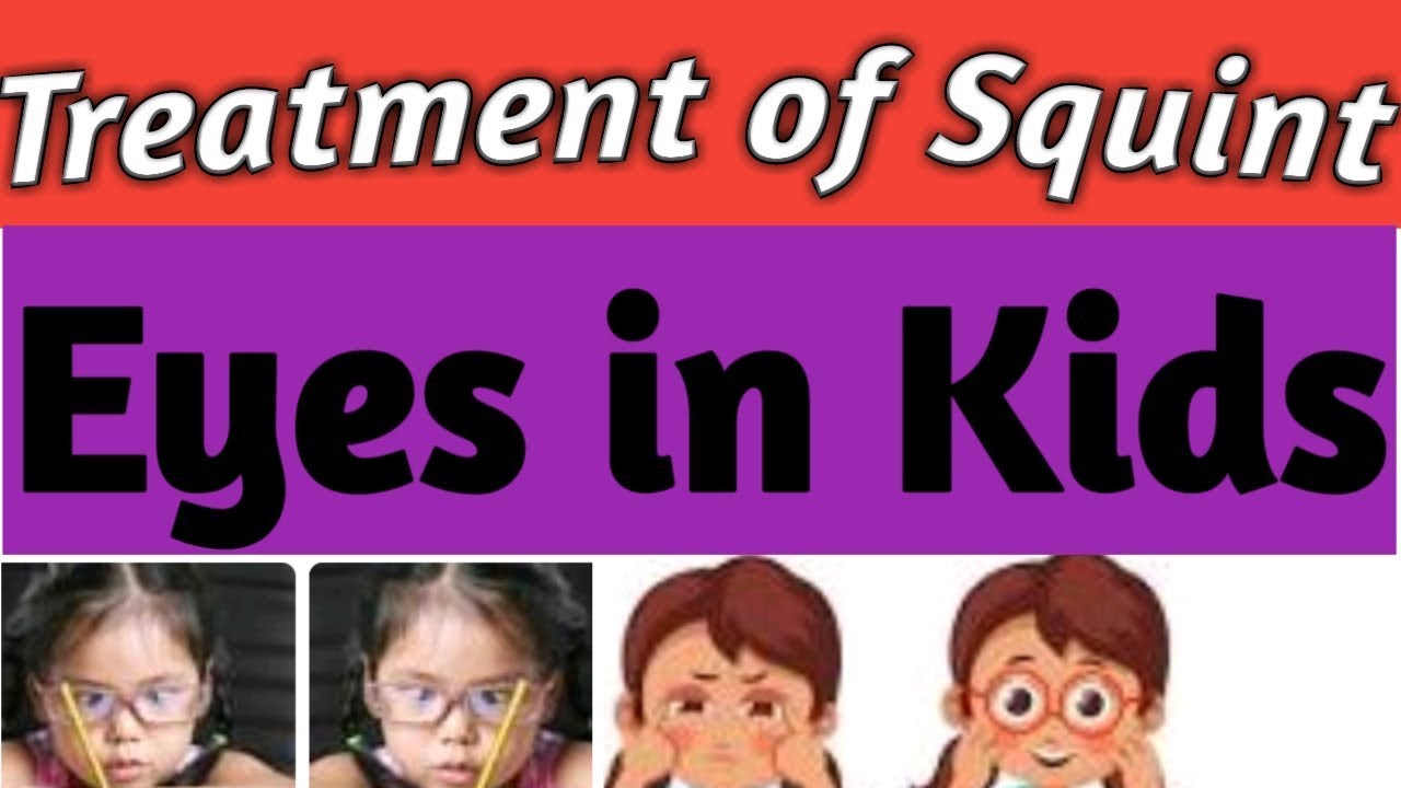 Treatment of Squint eye भैगापन का सटीक इलाज Lazy Eye Muscle