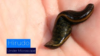 Hirudo Under Microscope