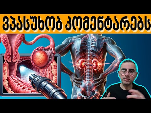 ვპასუხობ კომენტარებს: ცოტა ჭამით კუჭი პატარავდება? და სხვა კითხვები