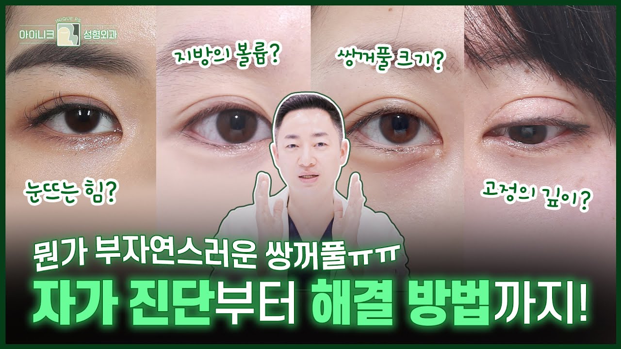 [눈 재수술] 쌍꺼풀 수술했는데 도대체 왜 안예쁜거죠?😥😥 | 인생라인을 만들기 위한 해결 방법!