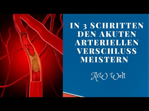 In 3 Schritten den akuten arteriellen Verschluss meistern