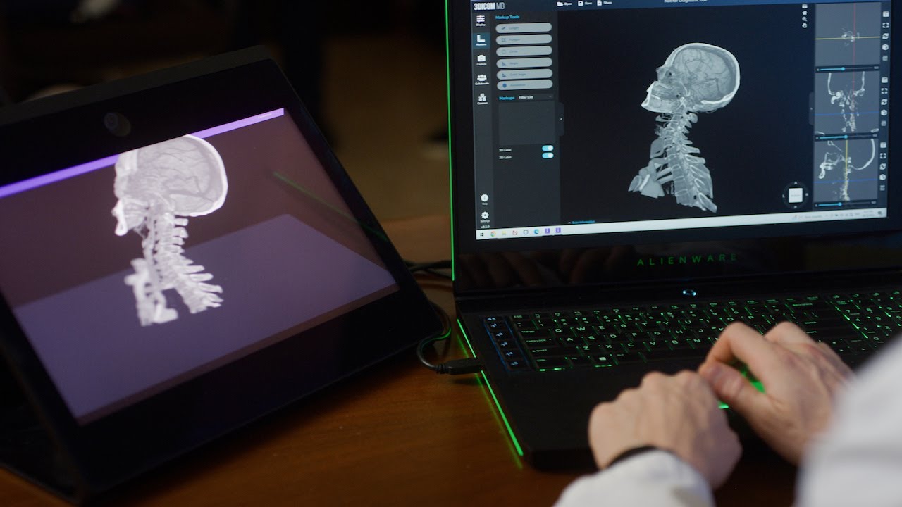 3Dicom MD for Sony's Spatial Reality Display