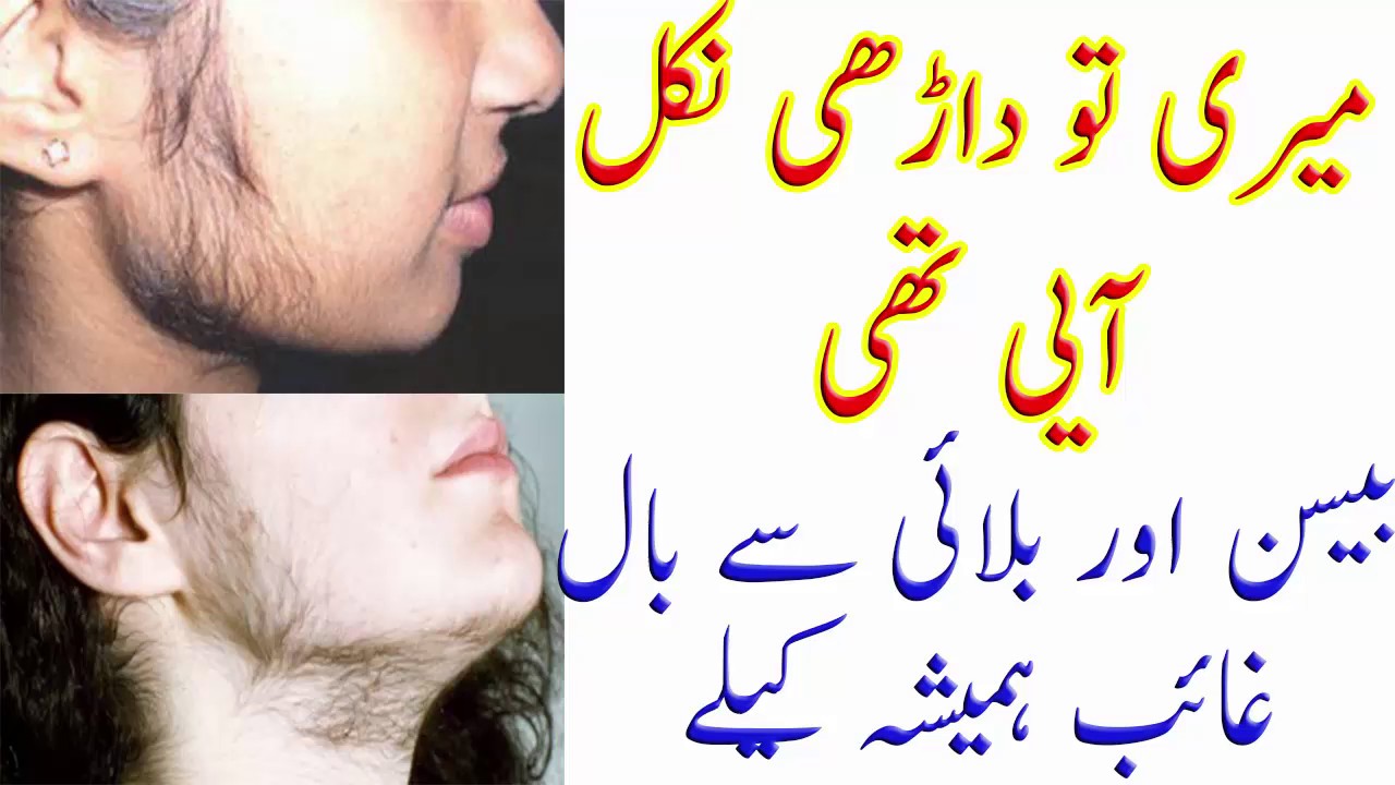 How To Remove Facial Hair INSTANTLY 100 % Natural - YouTube