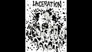 Download Lagu Laceration (IL) - Scabs (Demo 1992) MP3