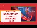 Systemic inflammatory response syndrome sirs