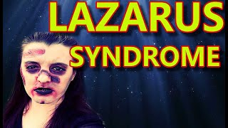 Lazarus Syndrome People RAISE from the DEAD