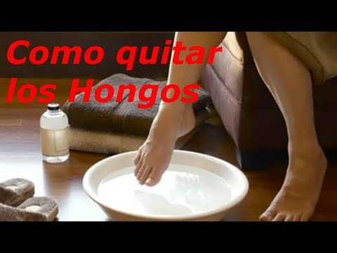 Como quitar los Hongos de las uñas de los pies?