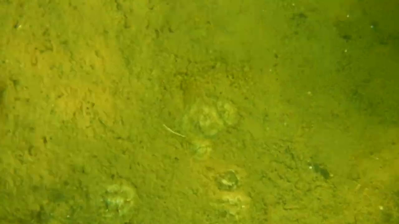 ver de vase (étang de l'estomac)