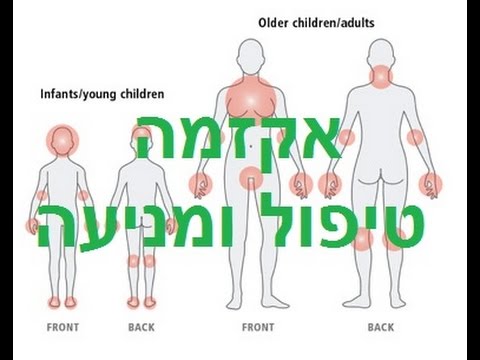 וִידֵאוֹ: אטופיק דרמטיטיס בילדים: סיבות, תסמינים, טיפול