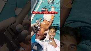 "What Is Intubation? Life-Saving Airway Procedure Explained!" #intubation #shorts