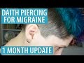 Daith Piercing for Migraine - 1 Month Update