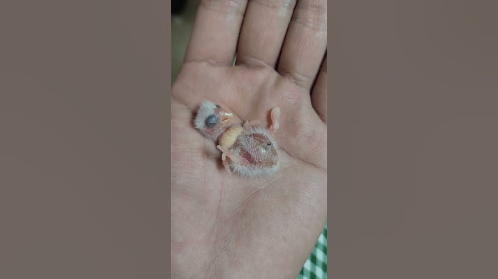 배꼽 딱지 2일차 navel belly button 2nd day