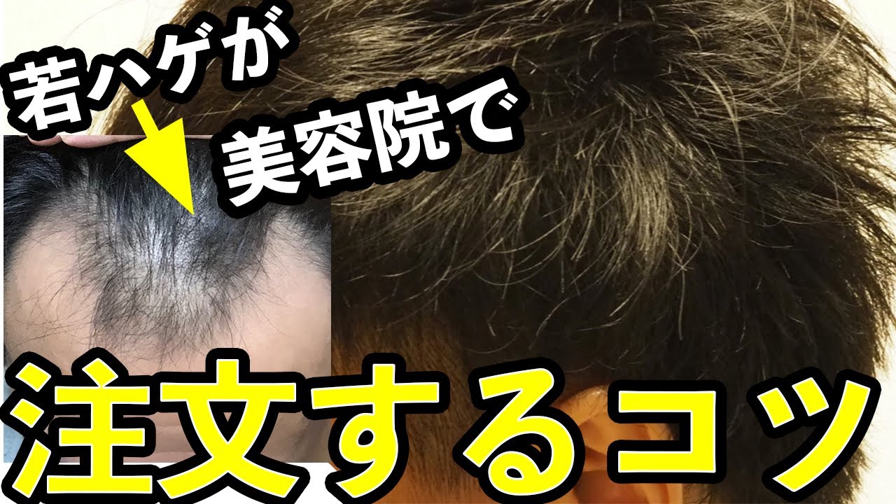 知って損なし 若ハゲが美容院で上手に注文するコツ Youtube