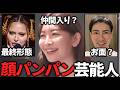 【ガルちゃん】顔が不自然…美容医療やりすぎだと思う芸能人教えて【有益2ch】