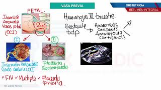 Obstetricia - Vasa previa